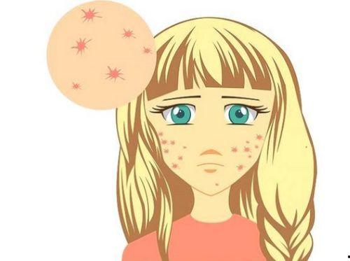 痘痘吃瓜,揭秘痘痘成因与饮食调理之道